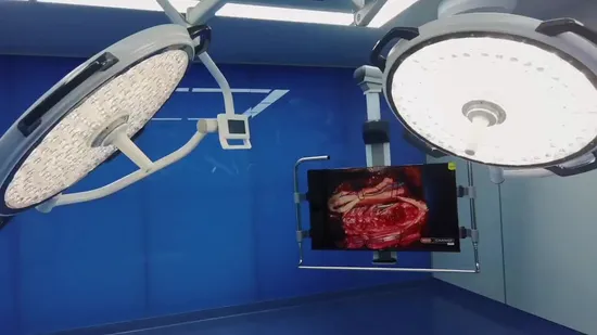Medical Surgical LED Hospital Shadowless Operating Lamp